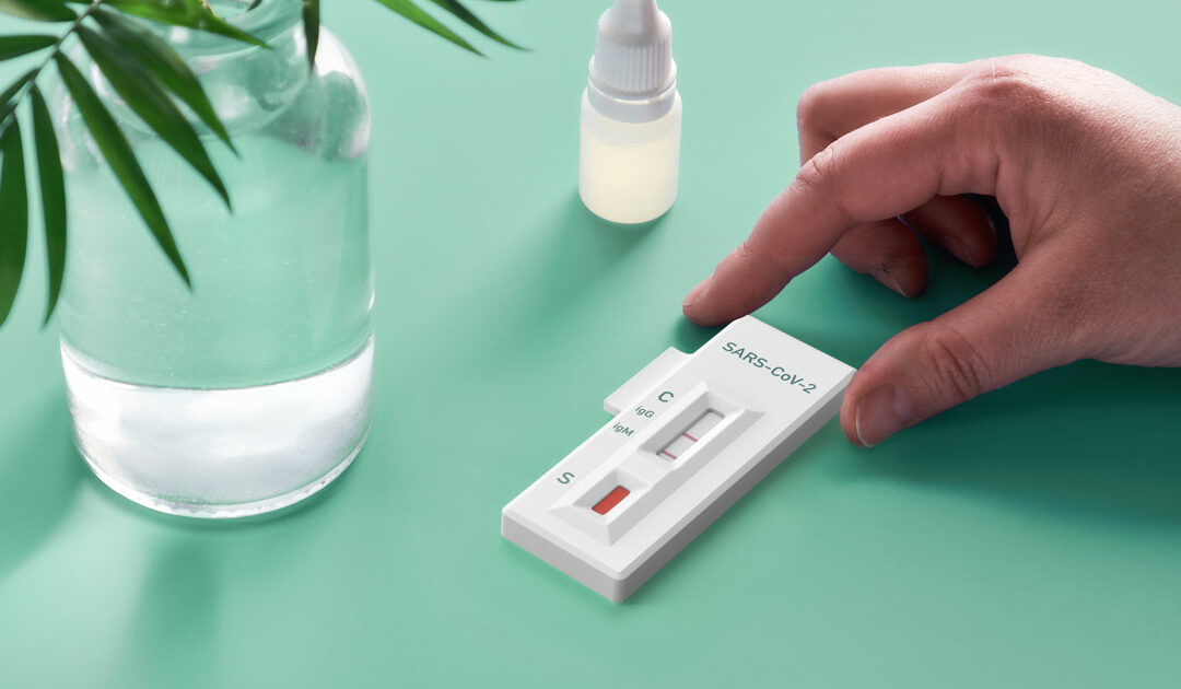 Differenze tra test sierologici e tamponi: cosa sapere